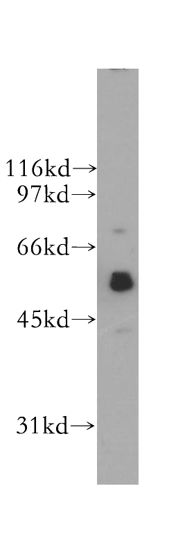 A375 cells were subjected to SDS PAGE followed by western blot with Catalog No:115227(SIGLEC9 antibody) at dilution of 1:400