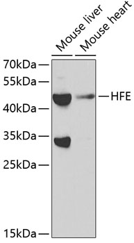 Western blot - HFE Polyclonal Antibody 