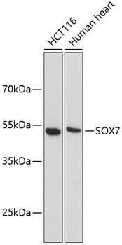 Western blot - SOX7 Polyclonal Antibody 