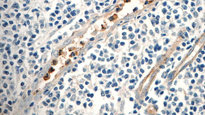 Immunohistochemistry of paraffin-embedded human tonsillitis tissue slide using Catalog No:113140(NFAM1 Antibody) at dilution of 1:50 (under 40x lens)