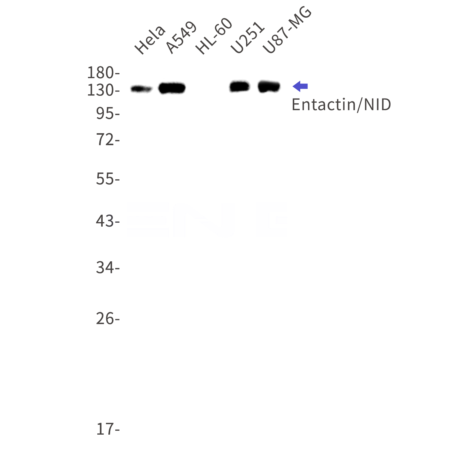 Western blot detection of Entactin/NID in Hela,A549,HL-60,U251,U87-MG cell lysates using Entactin/NID Rabbit mAb(1:1000 diluted).Predicted band size:136kDa.Observed band size:136kDa.