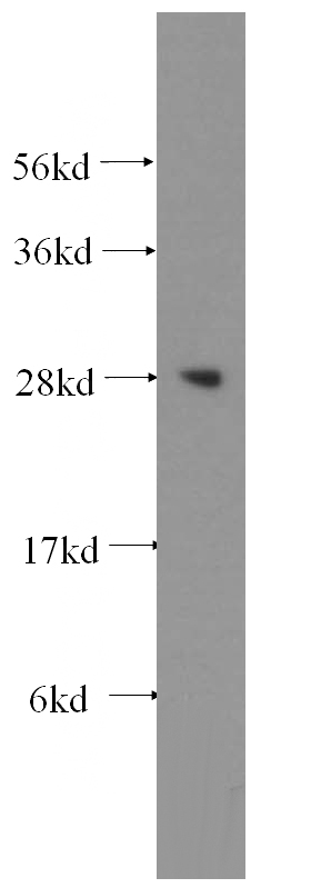 human heart tissue were subjected to SDS PAGE followed by western blot with Catalog No:112232(Lin28A-specific antibody) at dilution of 1:300