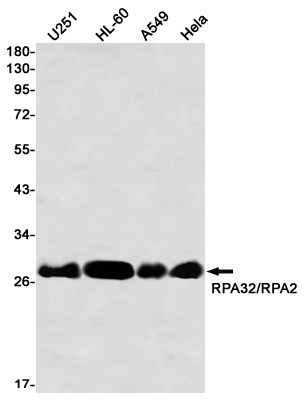 Western blot detection of RPA32/RPA2 in U251,HL-60,A549,Hale using RPA32/RPA2 Rabbit mAb(1:1000 diluted)