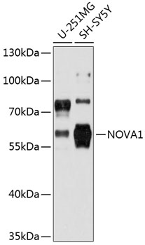 Western blot - NOVA1 Polyclonal Antibody 