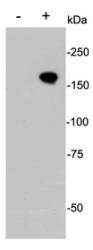 Fig1: Western blot analysis on CRISPR-Cas9 transfected 293 cells (+) and non transtected 293 cells (-).