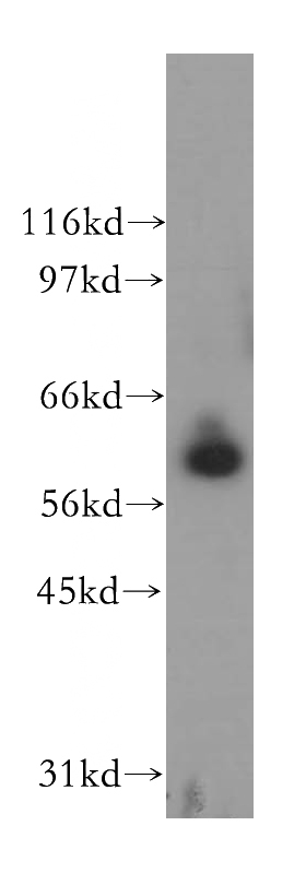 human kidney tissue were subjected to SDS PAGE followed by western blot with Catalog No:114128(PPIL2 antibody) at dilution of 1:400