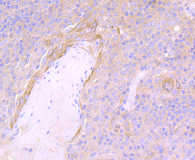 Fig3: Immunohistochemical analysis of paraffin-embedded human tonsil tissue using anti-NLRC3 antibody. Counter stained with hematoxylin.