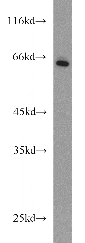 L02 cells were subjected to SDS PAGE followed by western blot with Catalog No:112781(MTM1 antibody) at dilution of 1:1000