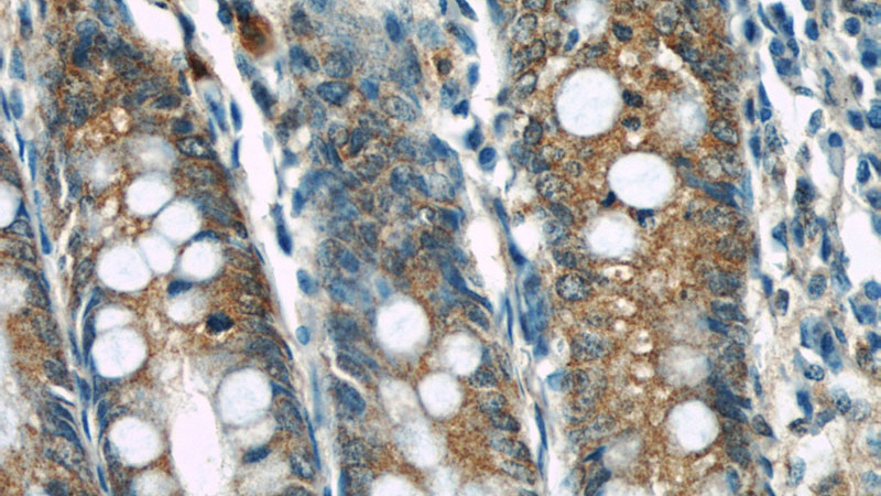 Immunohistochemical of paraffin-embedded human appendix using Catalog No:107218(FKBP52 antibody) at dilution of 1:100 (under 40x lens)