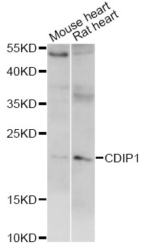 Western blot - CDIP1 Polyclonal Antibody 