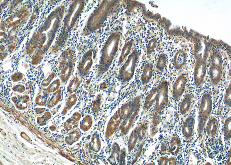 Immunohistochemistry of paraffin-embedded human stomach tissue slide using Catalog No:109413(CMC1 Antibody) at dilution of 1:50 (under 10x lens)