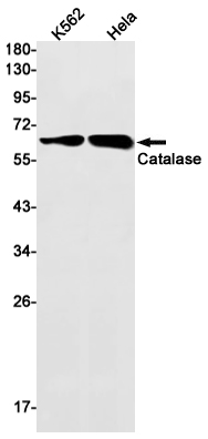 Western blot detection of Catalase in K562,Hela cell lysates using Catalase Rabbit mAb(1:1000 diluted).Predicted band size:60kDa.Observed band size:60kDa.
