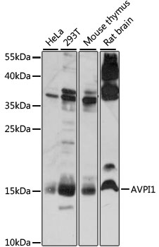 Western blot - AVPI1 Polyclonal Antibody 