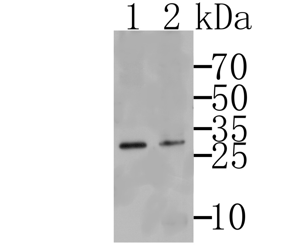 Fig1: Western blot analysis of Tmem248 on SkBr3 (1) and K562 cells lysates using anti-Tmem248 antibody.