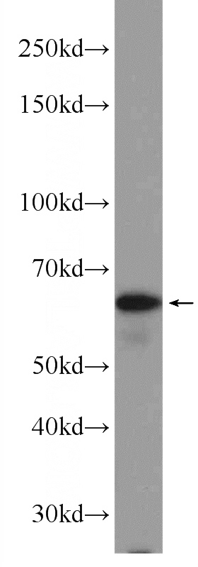 HL-60 cells were subjected to SDS PAGE followed by western blot with Catalog No:114103(PPP2R3B Antibody) at dilution of 1:1000