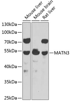 Western blot - MATN3 Polyclonal Antibody 