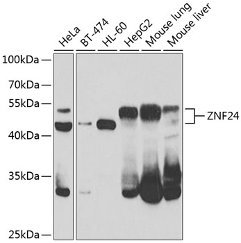 Western blot - ZNF24 Polyclonal Antibody 