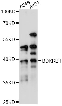 Western blot - BDKRB1 Polyclonal Antibody 