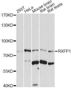 Western blot - RXFP1 Polyclonal Antibody 