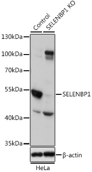 Western blot - SELENBP1 Polyclonal Antibody 