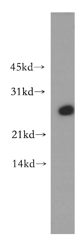 A431 cells were subjected to SDS PAGE followed by western blot with Catalog No:107777(ADAT2 antibody) at dilution of 1:400