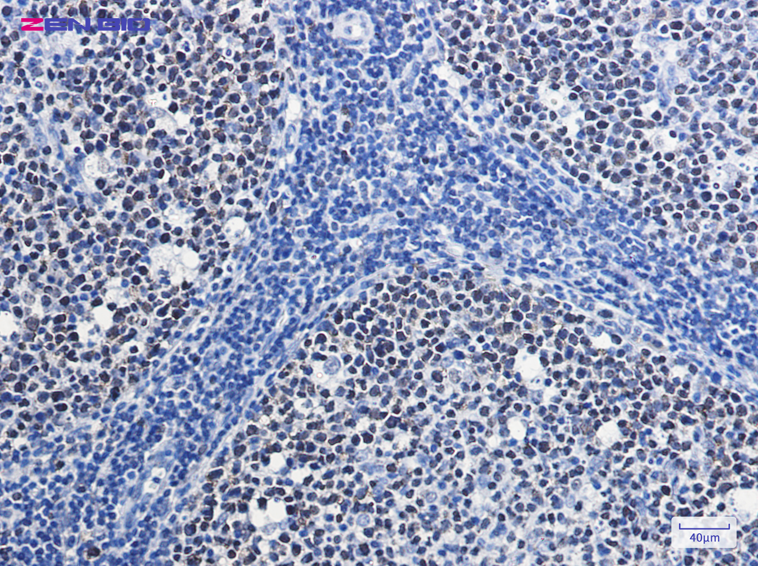 Immunohistochemistry of MCM7 in paraffin-embedded Human tonsil using MCM7 Rabbit pAb at dilution 1/20