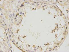 Fig2: Immunohistochemical analysis of paraffin-embedded human testis tissue using anti- UTF1 rabbit polyclonal antibodies.