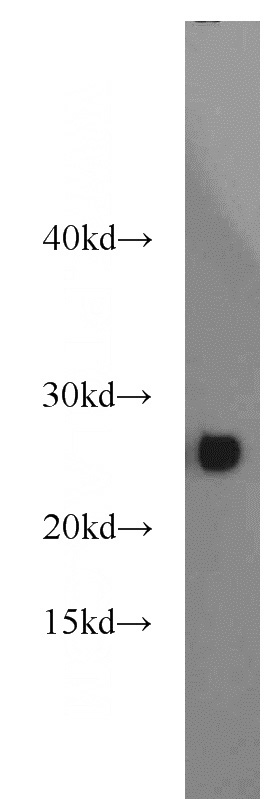 mouse testis tissue were subjected to SDS PAGE followed by western blot with Catalog No:111188(GSTM5 antibody) at dilution of 1:1000