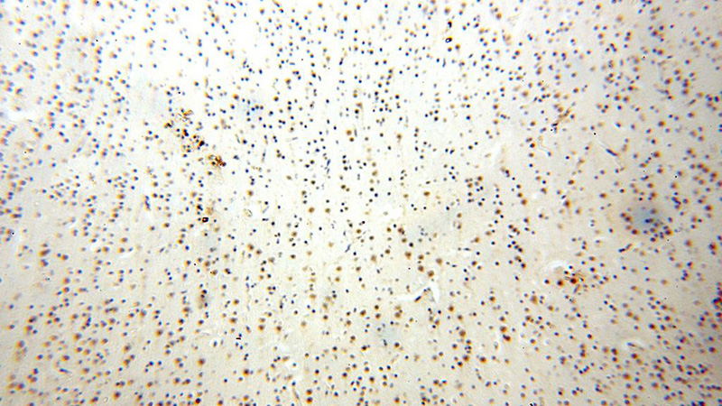 Immunohistochemical of paraffin-embedded human brain using Catalog No:116871(WDR5 antibody) at dilution of 1:100 (under 10x lens)