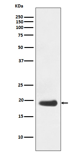Western blot analysis of eIF5A expression in Jurkat cell lysate.