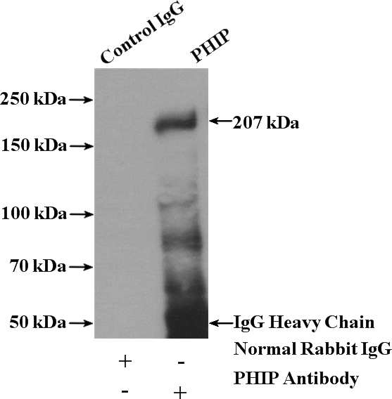 IP Result of anti-PHIP (IP:Catalog No:113817, 4ug; Detection:Catalog No:113817 1:3000) with A375 cells lysate 3600ug.