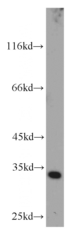 HeLa cells were subjected to SDS PAGE followed by western blot with Catalog No:109161(CDK4 antibody) at dilution of 1:1000