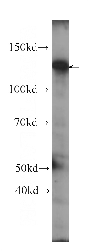 HeLa cells were subjected to SDS PAGE followed by western blot with Catalog No:107587(SIRT1 Antibody) at dilution of 1:1000