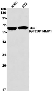 Western blot detection of IGF2BP1 in K562,3T3 cell lysates using IGF2BP1 Rabbit pAb(1:1000 diluted).Predicted band size:64kDa.Observed band size:64kDa.