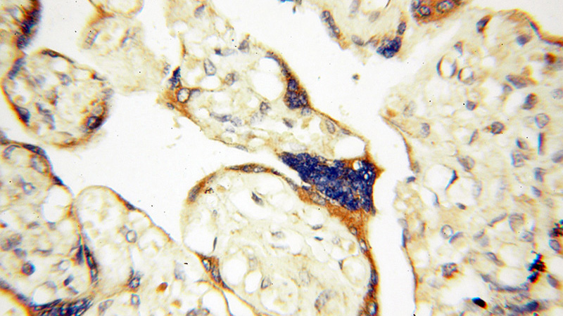 Immunohistochemical of paraffin-embedded human placenta using Catalog No:114276(PRR5 antibody) at dilution of 1:100 (under 40x lens)