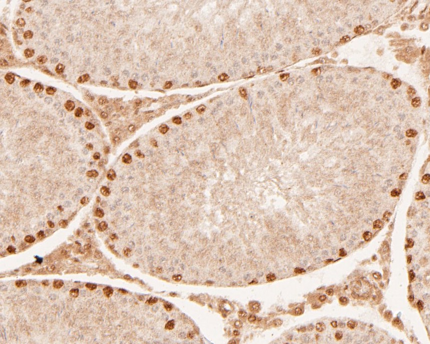 Fig3: Immunohistochemical analysis of paraffin-embedded rat testis tissue using anti-Dux antibody. The section was pre-treated using heat mediated antigen retrieval with sodium citrate buffer (pH 6.0) for 20 minutes. The tissues were blocked in 5% BSA for 30 minutes at room temperature, washed with ddH2O and PBS, and then probed with the primary antibody ( 1/200) for 30 minutes at room temperature. The detection was performed using an HRP conjugated compact polymer system. DAB was used as the chromogen. Tissues were counterstained with hematoxylin and mounted with DPX.