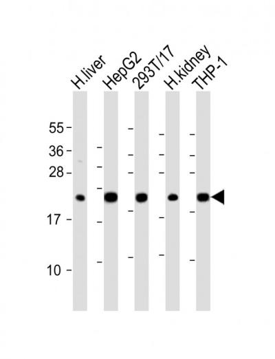 All lanes: Anti-GPX1 Antibody (C-term) at 1:2000 dilutionnLane 1: human liver lysatenLane 2: HepG2 whole cell lysatenLane 3: 293T/17 whole cell lysatenLane 4: human kidney lysatenLane 5: THP-1 whole cell lysatennLysates/proteins at 20 u03bcg per lane. nnSecondarynGoat Anti-Rabbit IgG,  (H+L), Peroxidase conjugated at 1/10000 dilution. nnPredicted band size: 22 kDannBlocking/Dilution buffer: 5% NFDM/TBST.
