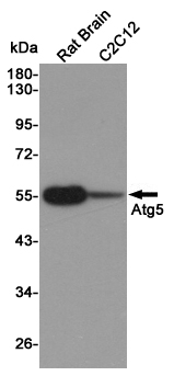 Western blot detection of Atg5 in Rat Brain and C2C12 cell lysates using Atg5 mouse mAb (1:1000 diluted).Predicted band size:55KDa.Observed band size:55KDa.