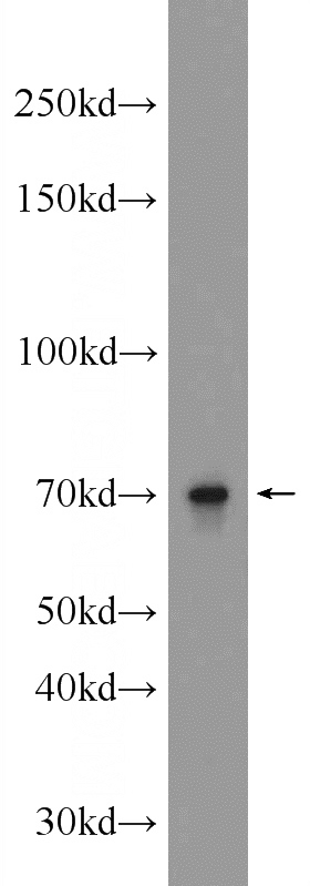 mouse testis tissue were subjected to SDS PAGE followed by western blot with Catalog No:107887(ALX3 Antibody) at dilution of 1:1000