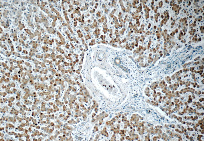 Immunohistochemistry of paraffin-embedded human liver tissue slide using Catalog No:108254(ARFIP2 Antibody) at dilution of 1:50 (under 10x lens)