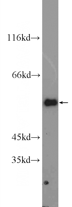 HeLa cells were subjected to SDS PAGE followed by western blot with Catalog No:110766(G6PD Antibody) at dilution of 1:1000