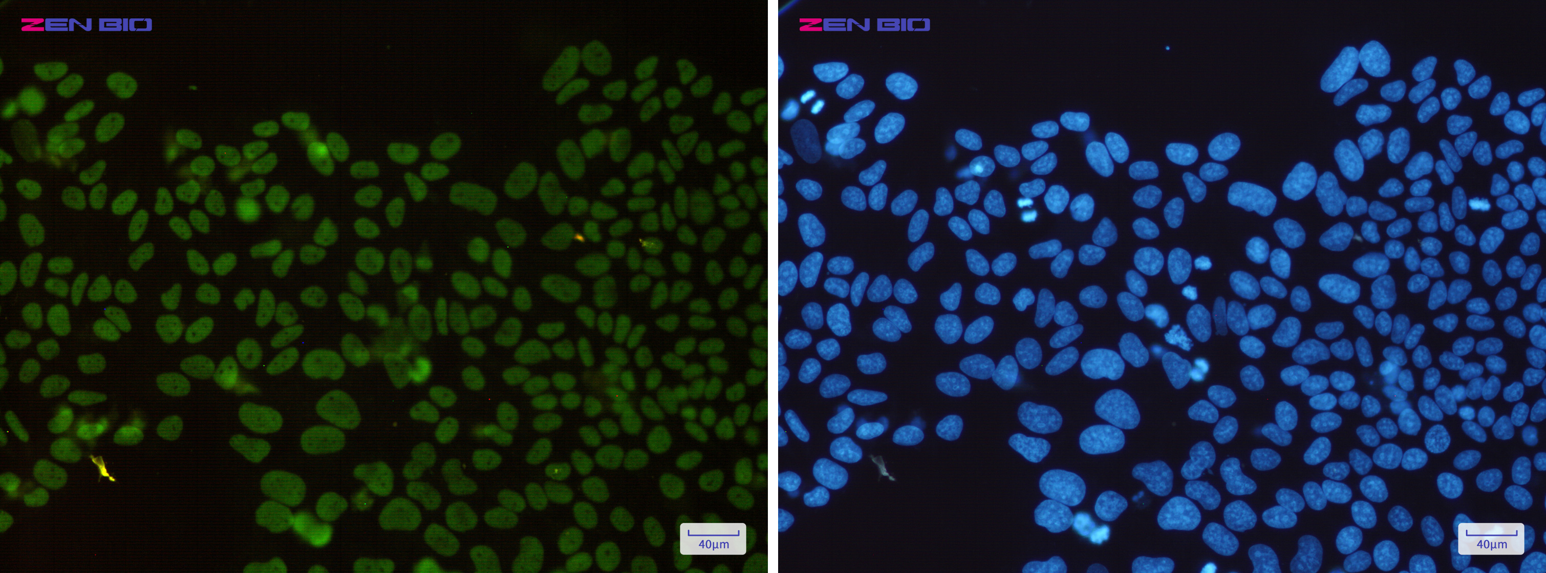 Immunocytochemistry of HDAC2(green) in Hela cells using HDAC2 Rabbit mAb at dilution 1/200, and DAPI(blue)