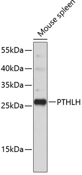 Western blot - PTHLH Polyclonal Antibody 