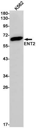 Western blot detection of ENT2 in K562 cell lysates using ENT2 Rabbit pAb(1:1000 diluted).Predicted band size:50kDa.Observed band size:60kDa.