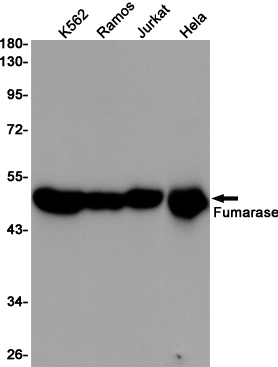 Western blot detection of Fumarase in K562,Ramos,Jurkat,Hela cell lysates using Fumarase (9B1) Mouse mAb(1:1000 diluted).Predicted band size:50KDa.Observed band size:50KDa.