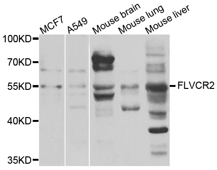 Western blot - FLVCR2 Polyclonal Antibody 