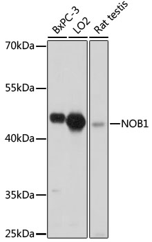 Western blot - NOB1 Polyclonal Antibody 