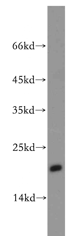 A2780 cells were subjected to SDS PAGE followed by western blot with Catalog No:112818(MRPL23 antibody) at dilution of 1:100