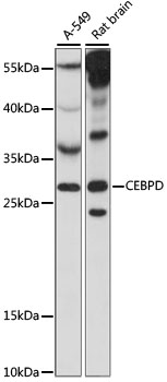 Western blot - CEBPD Polyclonal Antibody 
