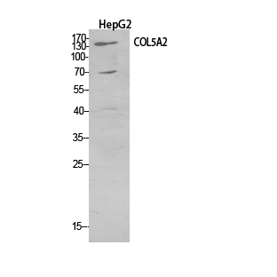 Fig1:; Western Blot analysis of HepG2 cells using COL5A2 Polyclonal Antibody.. Secondary antibody（catalog#：HA1001) was diluted at 1:20000